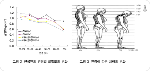 그림 2. 한국인의 연령별 골밀도의 변화, 그림3. 연령에 따른 체형의 변화